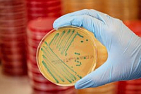 Listeria monocytogenes auf ALOA-Agar
